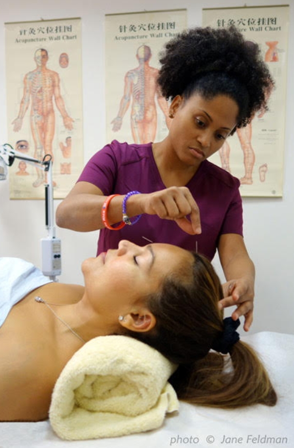 photo of Dr. Flora Luyando performing acupuncture treatment