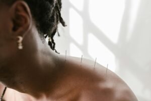 Treating the Effects of Domestic Violence with Acupuncture.